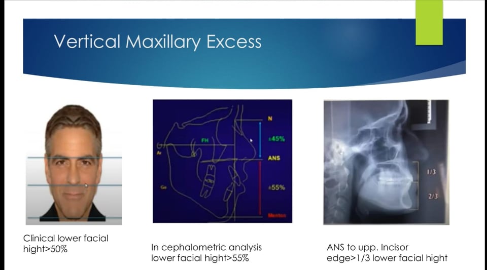 99292948 198078947889946 997544706122448896 n 4a9fd